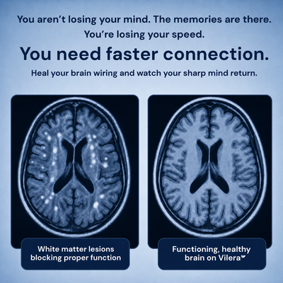 Vilera Tocotrienols - Brain Health