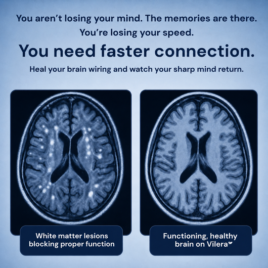 Vilera Tocotrienols - Brain Health
